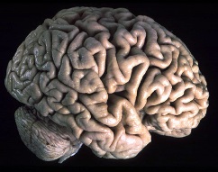 cervello2.jpg