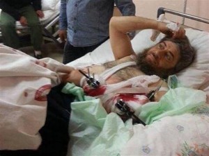 16 aprile 2014. Il comandante del DAESH Abu Muhammad,  ferito nei combattimenti a Idlib, viene curato all'ospedale statale di Hatay (fonte: Daily News).