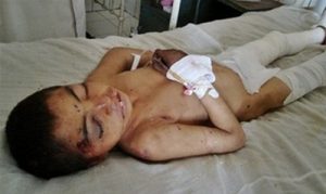 Agosto 2007. Uno dei feriti nel bombardamento del santuario di Ibrahim Shah Baba. Fonte: RAWA.